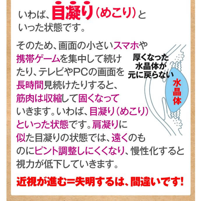 目凝りとも呼べる状態
